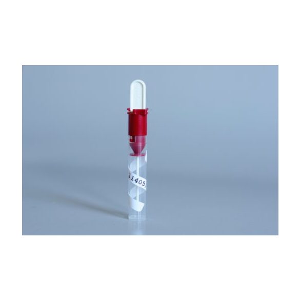 Enzimes béldaganatszűrő székletteszt (ScheBo Tumor M2-PK)