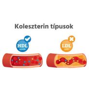 Koleszterin, magas koleszterinszint
