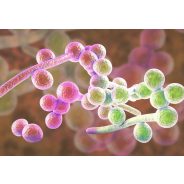 Candida, gombás megbetegedések