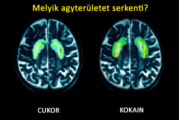 Cukor hatása megegyezik a kokainnal az agyban