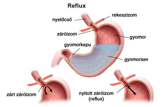 Refux folyamata